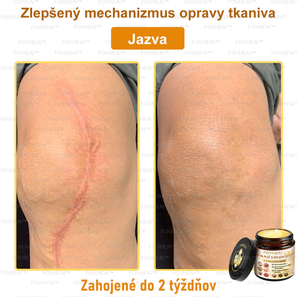 🐝🐝FOVHEAl™ Krém na pleť s úplným účinkom z včelieho jedu - 🧑⚕️Odporúčané dermatológmi - Vhodné pre všetky vekové kategórie - 50ml