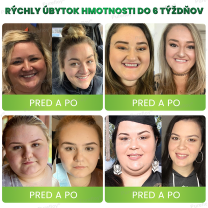🎉 Srdečne blahoželáme! Ste medzi prvými 150 vybranými zákazníčkami! ⏳ Teraz okamžite získavate 50% zľavu na našu chudnúcu formulu Purefloy®! Začnite svoju premenu – podporte svoj metabolizmus, znížte chuť do jedla a cíťte sa každý deň plná energie!
