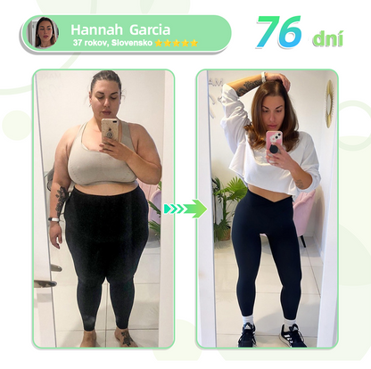 🍏🍏Voilaist® SMGT-GLP-1 Nano Mikroneedlová Náplasť (Bezbolestné, dlhotrvajúce, rieši cukrovku, obezitu a kardiovaskulárne ochorenia)