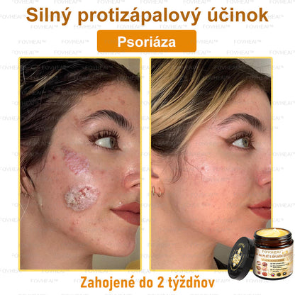 🐝🐝FOVHEAl™ Krém na pleť s úplným účinkom z včelieho jedu - 🧑‍⚕️Odporúčané dermatológmi - Vhodné pre všetky vekové kategórie - 50ml