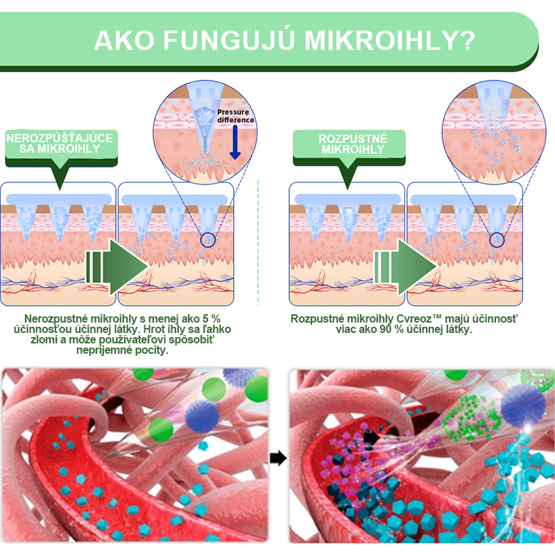🍏🍏Voilaist® SMGT-GLP-1 Nano Mikroneedlová Náplasť (Bezbolestné, dlhotrvajúce, rieši cukrovku, obezitu a kardiovaskulárne ochorenia)
