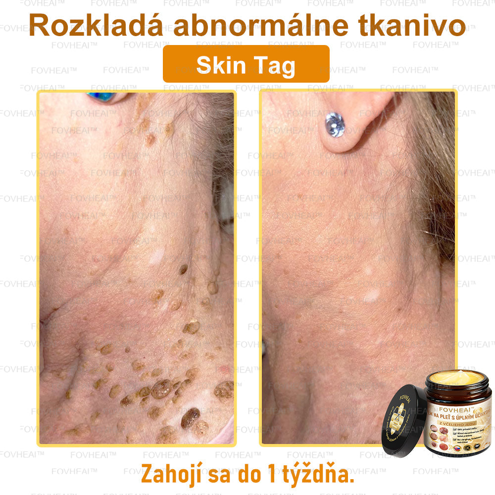 🐝🐝FOVHEAl™ Krém na pleť s úplným účinkom z včelieho jedu - 🧑‍⚕️Odporúčané dermatológmi - Vhodné pre všetky vekové kategórie - 50ml