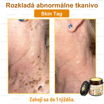 🐝🐝FOVHEAl™ Krém na pleť s úplným účinkom z včelieho jedu - 🧑‍⚕️Odporúčané dermatológmi - Vhodné pre všetky vekové kategórie - 50ml