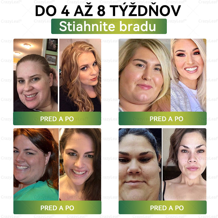 💙💙CrazyLeaf® 🫧Meglutide GLP-1 Aktivujúci Orálny Roztok 🫧 Obezita, kardiovaskulárne ochorenia, cukrovka, spánkové apnoe, problémy s kĺbmi a ďalšie