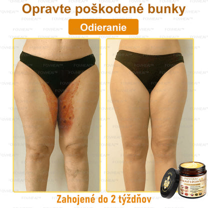 🐝🐝FOVHEAl™ Krém na pleť s úplným účinkom z včelieho jedu - 🧑‍⚕️Odporúčané dermatológmi - Vhodné pre všetky vekové kategórie - 50ml
