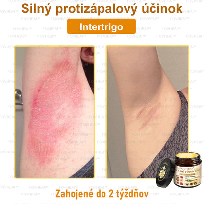 🐝🐝FOVHEAl™ Krém na pleť s úplným účinkom z včelieho jedu - 🧑‍⚕️Odporúčané dermatológmi - Vhodné pre všetky vekové kategórie - 50ml