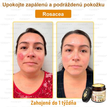 🐝🐝FOVHEAl™ Krém na pleť s úplným účinkom z včelieho jedu - 🧑‍⚕️Odporúčané dermatológmi - Vhodné pre všetky vekové kategórie - 50ml