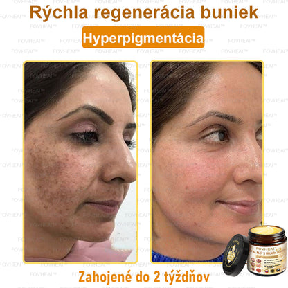 🐝🐝FOVHEAl™ Krém na pleť s úplným účinkom z včelieho jedu - 🧑‍⚕️Odporúčané dermatológmi - Vhodné pre všetky vekové kategórie - 50ml