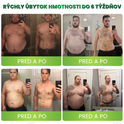 🎉 Srdečne blahoželáme! Ste medzi prvými 150 vybranými zákazníčkami! ⏳ Teraz okamžite získavate 50% zľavu na našu chudnúcu formulu Purefloy®! Začnite svoju premenu – podporte svoj metabolizmus, znížte chuť do jedla a cíťte sa každý deň plná energie!
