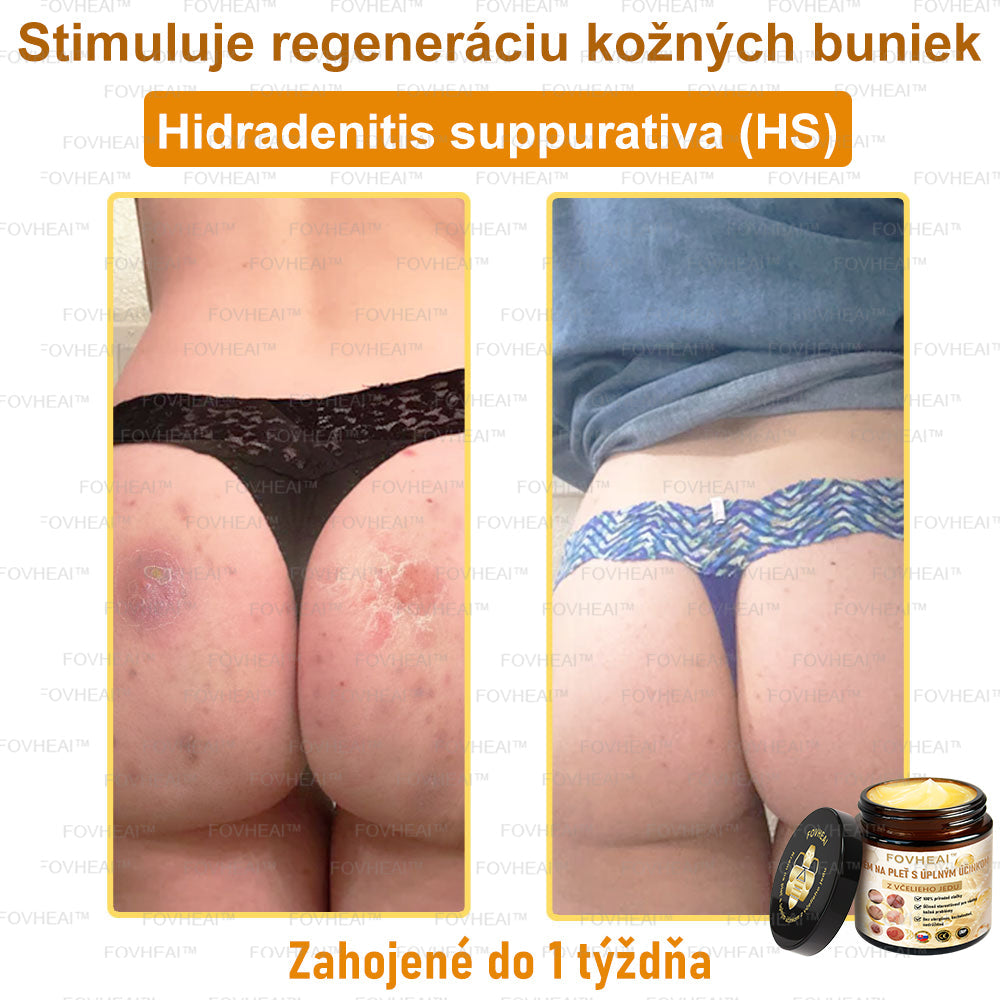 🐝🐝FOVHEAl™ Krém na pleť s úplným účinkom z včelieho jedu - 🧑‍⚕️Odporúčané dermatológmi - Vhodné pre všetky vekové kategórie - 50ml