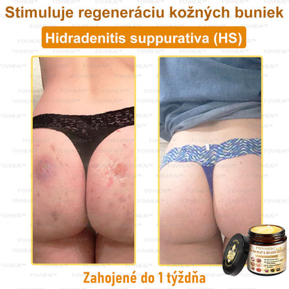 🐝🐝FOVHEAl™ Krém na pleť s úplným účinkom z včelieho jedu - 🧑‍⚕️Odporúčané dermatológmi - Vhodné pre všetky vekové kategórie - 50ml